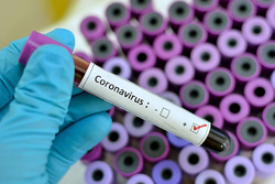 Вторая жертва COVID-19: в Тамбовской области умерла 73-летняя женщина с диагнозом коронавирус
