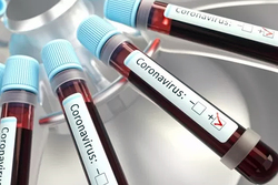 В Тамбовской области прирост заболевших COVID-19: выявлено 75 новых случаев коронавируса