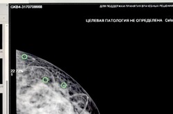 Искусственный интеллект помогает тамбовским медикам ставить диагноз